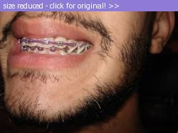 Posted image has been reduced in size. Size of original image (51963 KB) is 604 x 453 pixels. Click image to view full size and better quality!